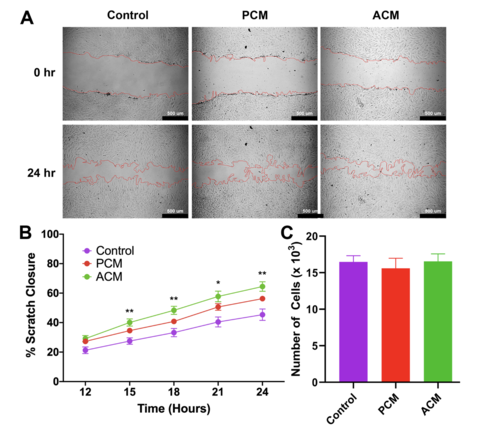 Wound Healing with Fat Cells diagram - Sander and Ankrum