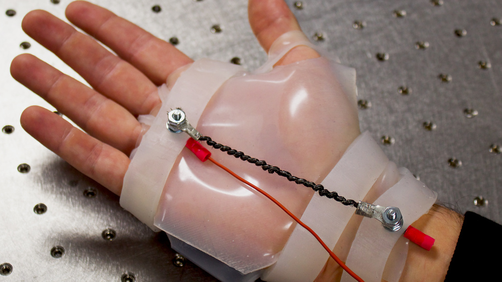 The Robotic Rehabilitation Device fitted on a hand
